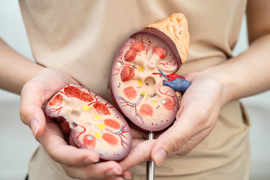 Kidney model held in hands – Dr. Sarin kidney specialist