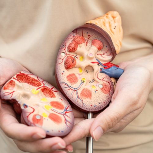 Kidney Transplant vs. Dialysis: Which is Right for You?